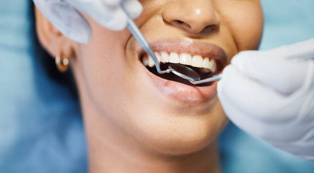 Best Weekend Emergency Dentist in Severance, CO